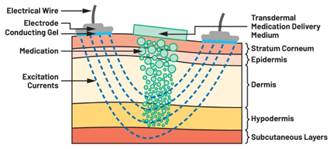  圖5.人體皮膚分層橫截面以及TMD和生物阻抗測量  考慮到生物阻抗分析的無創(chuàng)性，使用兩個金屬電極代表電氣傳感器，連接模擬前端(AFE)電路和患者皮膚。這個金屬與非金屬的接觸點(diǎn)是構(gòu)成整個電路的另一個關(guān)鍵部分，連接了AFE和人體電氣模型。電荷載體（電極中的電子和人體內(nèi)的離子）之間的相互作用可能對這些傳感器的性能產(chǎn)生重大影響，需要根據(jù)每種應(yīng)用進(jìn)行具體考慮。首先，金屬與離子溶液接觸的相互作用導(dǎo)致金屬表面附近溶液中離子濃度的局部變化。這種現(xiàn)象會改變電極下方區(qū)域的電荷中性，導(dǎo)致金屬周圍的電解質(zhì)電位與溶液其余部分不同，從而在金屬和電解質(zhì)主體之間產(chǎn)生一個電位差，即常說的“半電池電位”。其次，注入電流的直流分量會導(dǎo)致電極極化。  表1.各種電極類型和相應(yīng)的半電池電位  金屬及反應(yīng)  半電池電位(V)  Al → Al3+ + 3e- Al → Al3+ + 3e-  –1.706 –1.706  Ni → Ni2+ + 2e- Ni → Ni2+ + 2e-  –0.230 -0.230  H2 → 2H+ + 2e- H2 → 2H+ + 2e-  0.000 (by definition) 0.000（根據(jù)定義）  Ag + Cl- → AgCl + e- Ag + Cl- → AgCl + e-  +0.223 +0.223  Ag → Ag+ + e- Ag → Ag+ + e-  +0.799 +0.799  Au → Au+ + e- Au → Au+ + e-  +1.680 +1.680  這是一種不良現(xiàn)象，往往導(dǎo)致電極性能下降。這些考量表明，電極也需要定義適當(dāng)?shù)碾姎饽Ｐ停▍⒁妶D6）。我們可以將干電極表示為具有三個串聯(lián)元件的電路：一個用于模擬半電池電位(EHC)的直流電源；一個用于模擬金屬和非金屬（人體）之間接觸的RC并聯(lián)電池(Rd||Cd)；以及一個用于模擬電極金屬的電阻Rs。